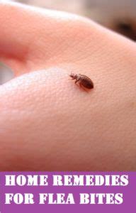 How to Treat Flea Bites in Humans; 7 Tried & Tested Home Remedies