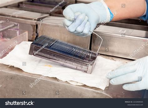 Scientist Staining Microscope Slides Cytology Studies Stock Photo 2210409545 | Shutterstock