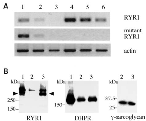 Expression of RYR1 in lymphoblastoid cells. RT – PCR were performed ...