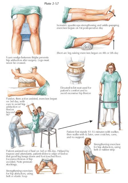 REHABILITATION AFTER TOTAL HIP REPLACEMENT | Total hip replacement, Hip ...