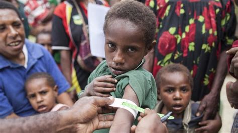 Malnutrition on the rise for a third consecutive year - UN report - Ventures Africa