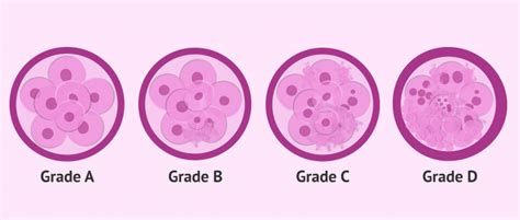 Embryos in IVF are classified according to their quality