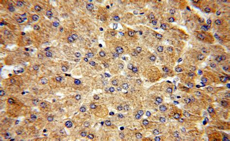 Alpha galactosidase A Rabbit Polyclonal antibody