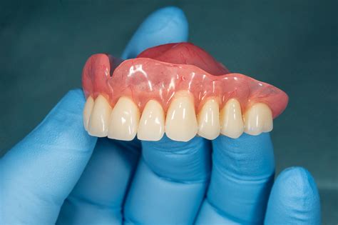 Can Dentures Rebuild Your Smile? | Springfield, OH