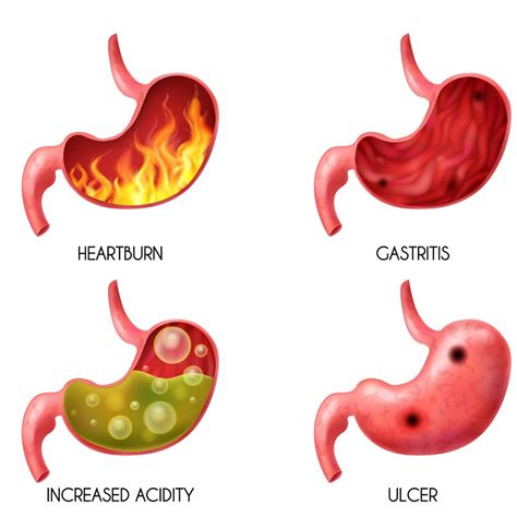 What is Erythematous Mucosa