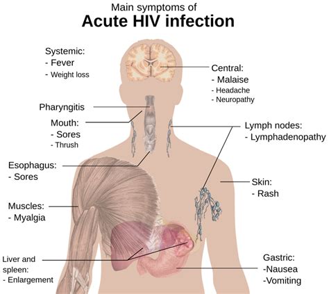 HIV infection symptoms – MOBIEG