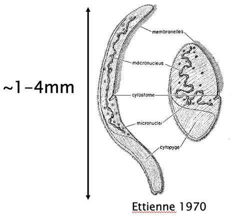 Spirostomum Under Microscope