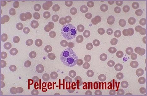 Important Facts About Pelger-Huët Anomaly In Cats That You Need To Know - Cat Lovers