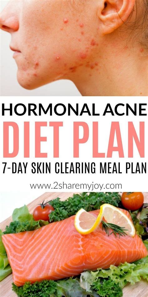 Hormonal Acne Diet Plan (best 7-day clear skin meal plan) | Clear skin diet, Food for acne, Best ...