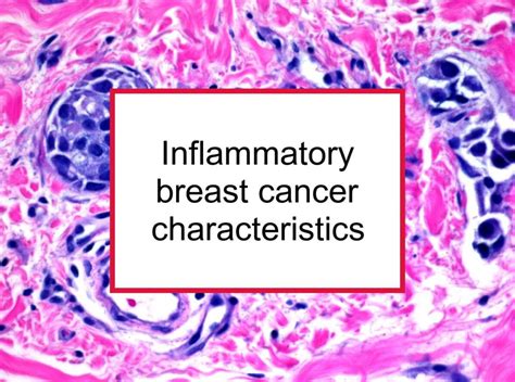 Inflammatory breast cancer: Best Health Guide 2023 - eHealth Magazine