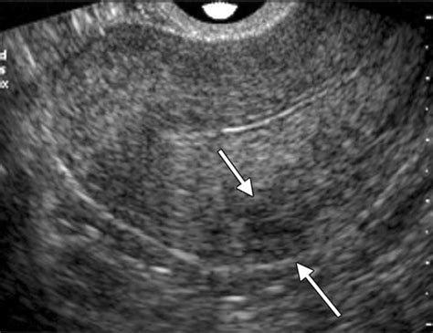 [最新] heterogeneous uterus 180779-Heterogeneous uterus meaning (2023)