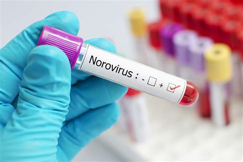 Norovirus Outbreak Hits One Central New York Town