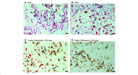 | Characterization of CD74 expressing cells in proliferative diabetic ...