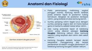 Culdocentesis.pptx