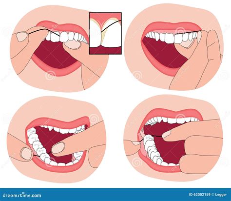 How to floss your teeth stock vector. Illustration of floss - 62002159