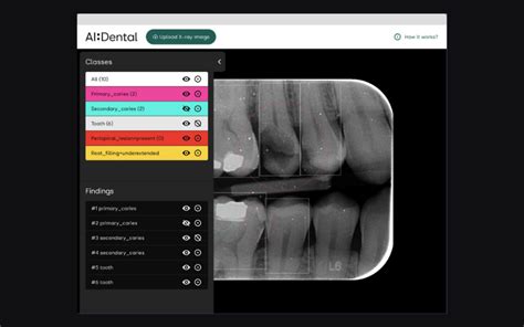 AI:Dental | AI in dentistry - Aston ITM