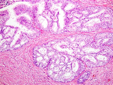 Prostate Histology Labeled