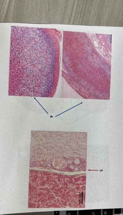 Solved which one is PITUITARY GLAND, THYROID GLAND, | Chegg.com