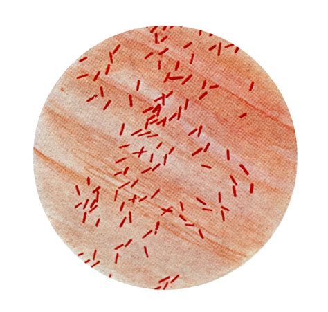 Free picture: photomicrograph, escherichia coli, bacillus, coli, bacteria, gram, stain, technique