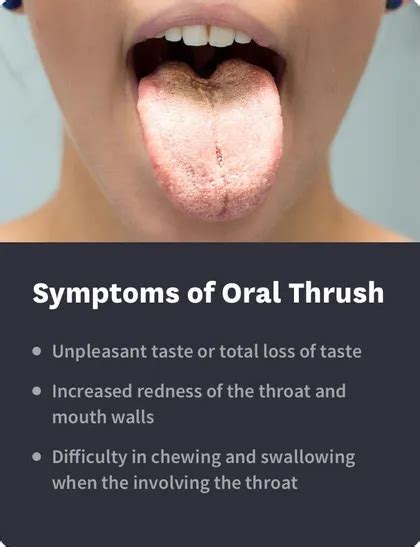 Thrush Throat