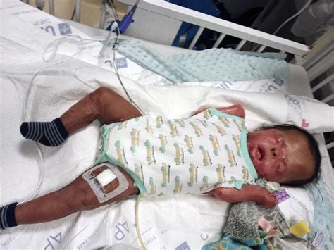 Ja’bari Gray, San Antonio baby born without skin, finally goes home