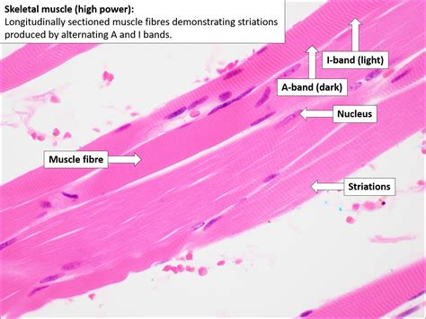 Skeletal Muscle – Normal Histology – NUS Pathweb :: NUS Pathweb