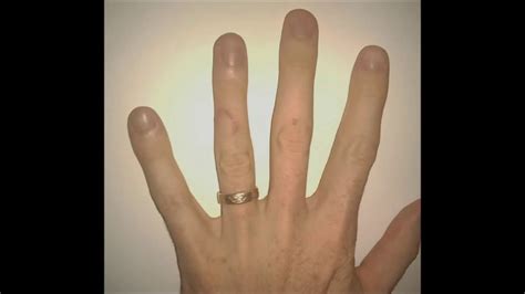 Time lapse of my cut finger healing - YouTube