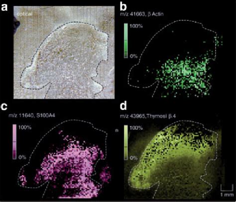 Figure 1 from IMAGING MASS SPECTROMETRY mass spectrometry combines the ...