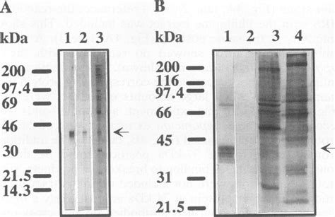 Western blot of anti-GAPDH affinity-purified antibodies and HRS with... | Download Scientific ...