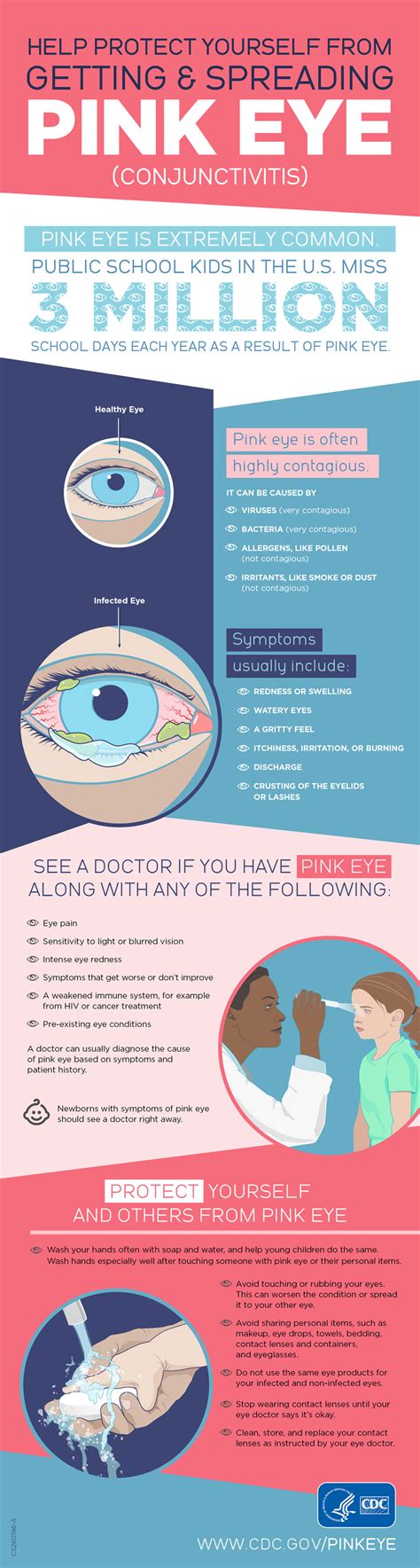 How To Treat Pink Eye – drdougcrosby.com