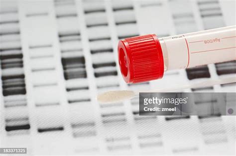 646 Dna Swab Test Stock Photos, High-Res Pictures, and Images - Getty Images