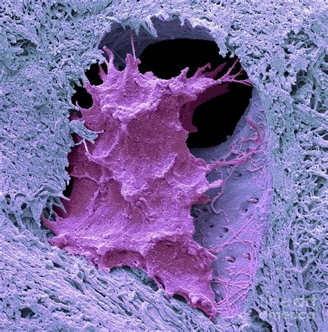 Osteocyte Bone Cell Photograph By Steve Gschmeissner Science Photo ...