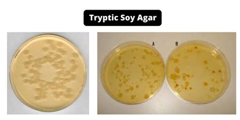 Tryptic Soy Agar (TSA) - Composition, Principle, Preparation, Results, Uses - Biology Notes Online