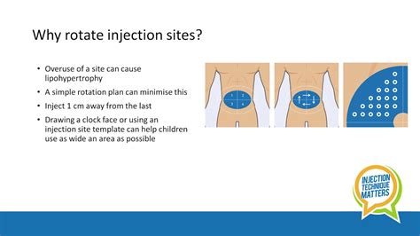 Insulin Injection Technique