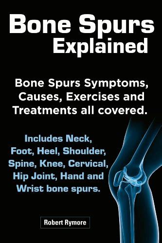 Bone Spurs explained. Bone Spurs Symptoms, Causes, Exercises and Treatments all covered ...