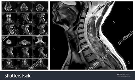 7,059 Radiology Human Mri Images, Stock Photos & Vectors | Shutterstock