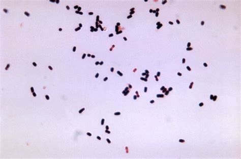 Free picture: gram, photomicrograph, gram, positive, clostridium perfringens, welchii