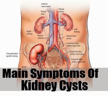 Wellness Lab Health Info: What To Do With My Kidney Cyst??