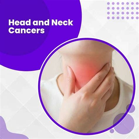 Head and Neck Cancer, Signs and Symptoms | Uhapo