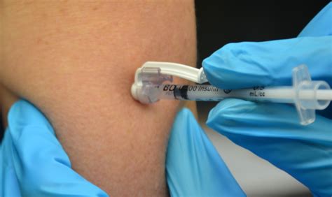 7.3 Intradermal and Subcutaneous Injections – Clinical Procedures for Safer Patient Care