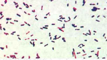 Clostridium perfringens : 네이버 블로그