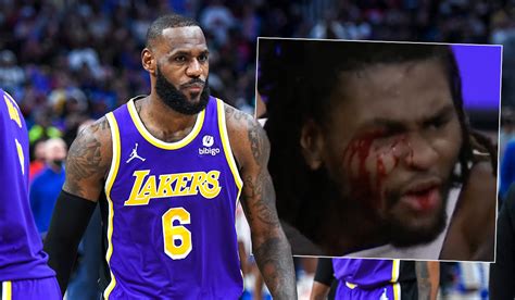 Watch: LeBron James ejected after leaving opponent bloodied in nasty ...