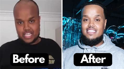 Chunkz Hair Transformation in real time (Gallery Inside) | Heartafact