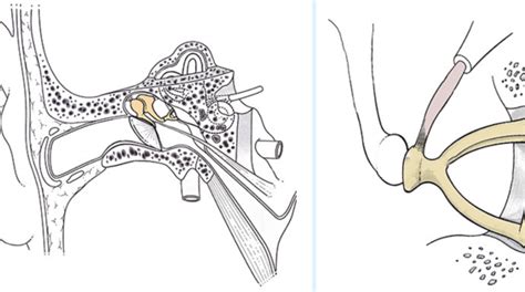 Stapedectomy Specialist in Kolkata | Anksh Ent Institute