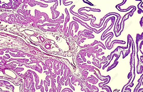 Fallopian tube ampulla, light micrograph - Stock Image - C051/7166 - Science Photo Library