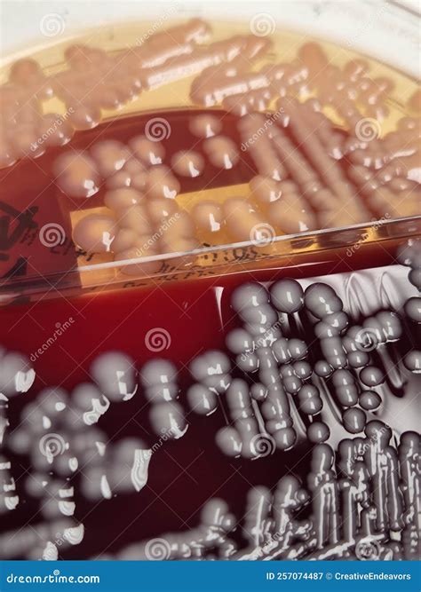 Klebsiella Pneumoniae Bacteria Growing on Blood and Macconkey Agar Stock Image - Image of ...