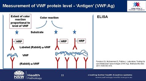 Laboratory testing for von Willebrand disease Emmanuel J