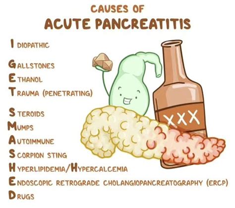 Pancreatitis Causes