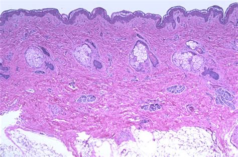 Sweat Gland Histology