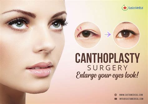 Medical Canthoplasty Surgery...